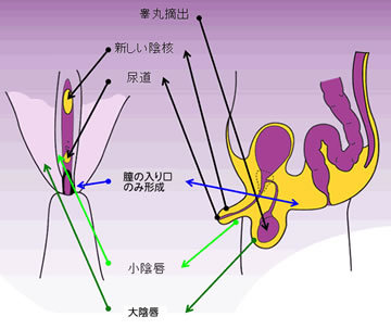 【やや閲覧注意】実録!タイの性器事情 ニューハーフになるためのすべての画像2