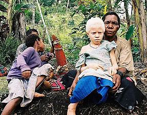 albino0414.jpg