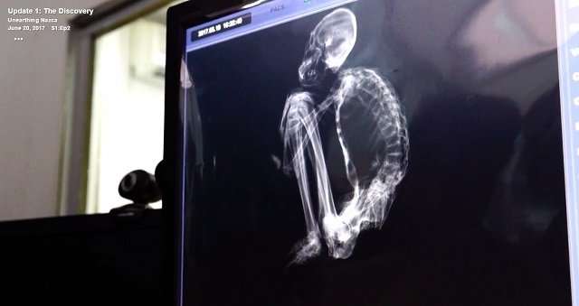 【衝撃】全身真っ白の「3本指のミイラ」が複数発見される! 医師「人間とは異なる1600年前のヒト型生物」DNA検査へ=ナスカ の画像5