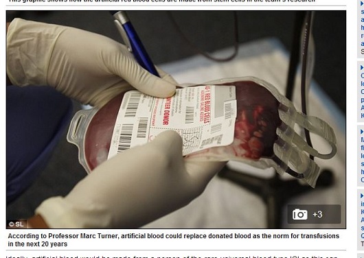 iPS細胞で「人工血液」を大量生産!?　献血も不要に!?の画像1