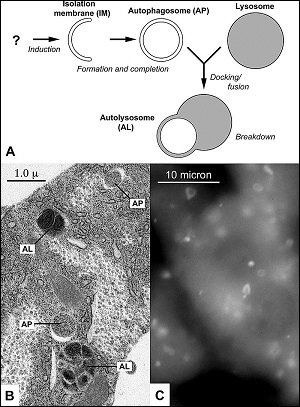 autophagy_2.jpg