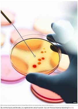 【衝撃生物学】微生物に記憶力があることが判明!しかしある理由から記憶喪失に…!の画像2