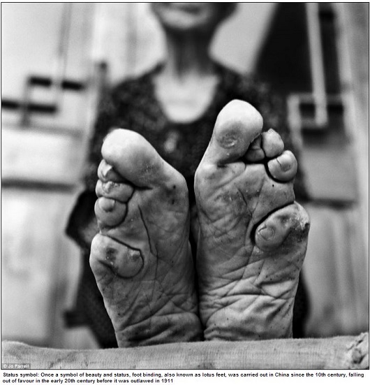 変形したつま先 折り畳まれた指 中国最後の纏足女性が写真集に