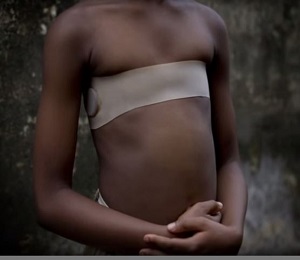 【奇習】女性器切除だけではない！ 少女の胸にアイロンがけする「ブレストアイロニング」の残酷な実態！の画像3