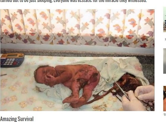 24時間生き埋めにされた赤ん坊が生還！ アルマジロの巣穴の中で一体何が？ ＝ブラジルの画像3