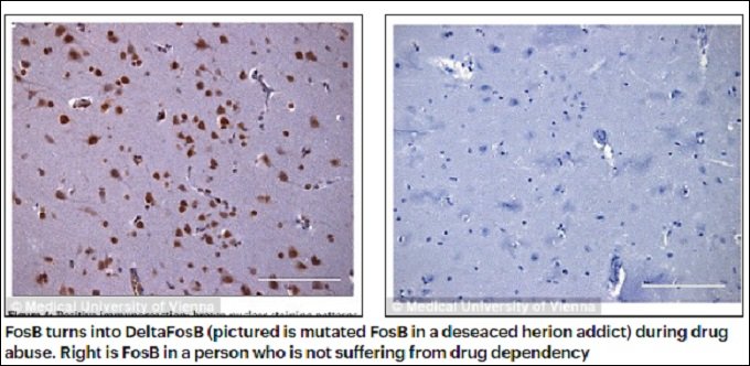 ヘロイン中毒者の体は死後も薬物を欲しがることが判明 奇形タンパク質 Deltafosb の恐怖