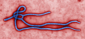 人間を爆裂させる「エボラ」は本当に天然ウイルスか？  生物兵器の可能性に科学ライターが迫る！の画像1