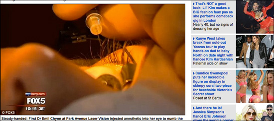 eye1123-2.jpg