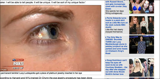 eye1123.jpg