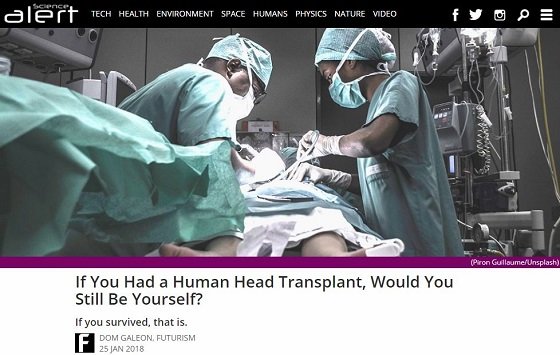 世界初・人間の「頭部移植手術」成功、その後…！頭部切断後に躰は動くのか？の画像2