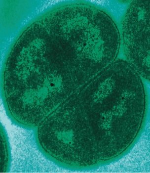 【科学】「人間の死体を他惑星に送れ」米生物学者が人間から地球外生命を誕生させる「逆パンスペルミア説」を提唱!の画像2