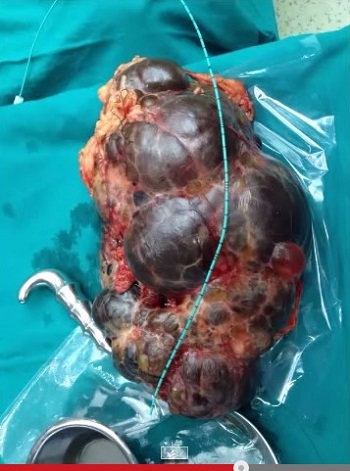 kidneys.jpg