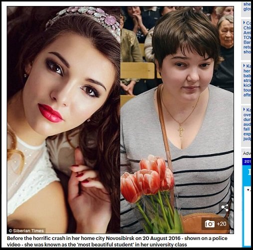 ロシアの超絶美女が2年間で 別人の容姿 に变化した悲劇の理由とは 激太り 視力喪失 友人も彼氏も失い