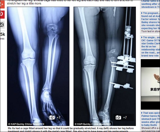leg_2.jpg