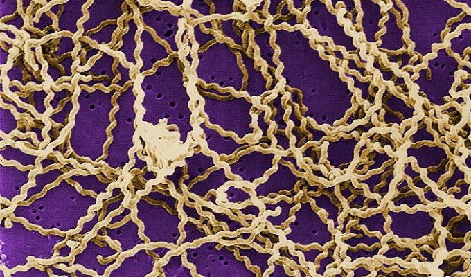 leptospirosis.jpg