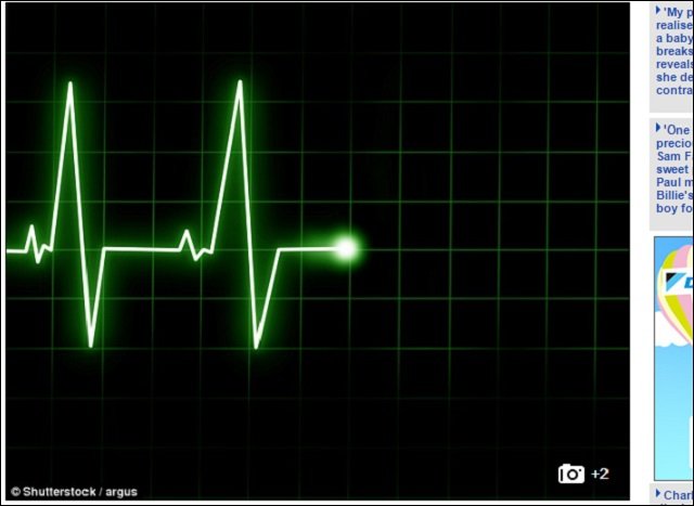 【ガチ】人が死んだ後に生きる謎の10分間があった! 研究者「説明不可能な事態」の画像2