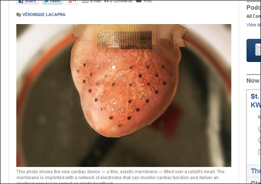 これが未来のペースメーカーだ！　3Dプリンターで作るから、どんな心臓にもぴったりフィット!!の画像1
