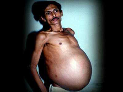 pregnantman-1.jpg