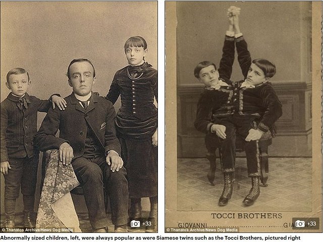 巨人症 アルビノ 結合双生児 奇形を見世物にした19世紀のフリークショー出演者たち19人大集合