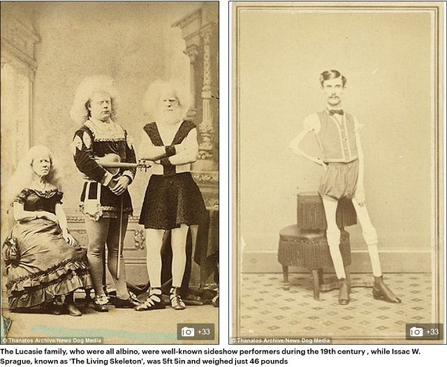 巨人症、アルビノ、結合双生児… 奇形を見世物にした19世紀のフリークショー出演者たち19人大集合！の画像3