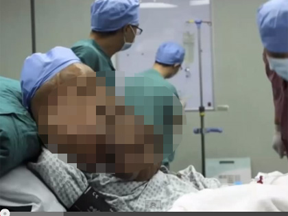 現実に生きるエレファントマン 顔に17.5キロの腫瘍を持つ男、記録的に深刻なケースの画像1