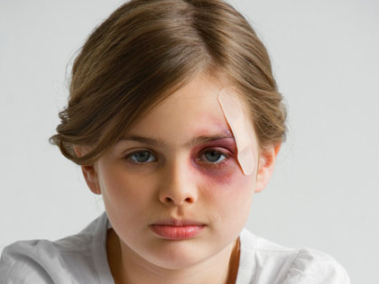 母親らの虐待で食事与えられず、排泄物まみれで死亡した10才少年!殴る・蹴る・性的暴行…なぜ見過ごされた?=米国の画像1