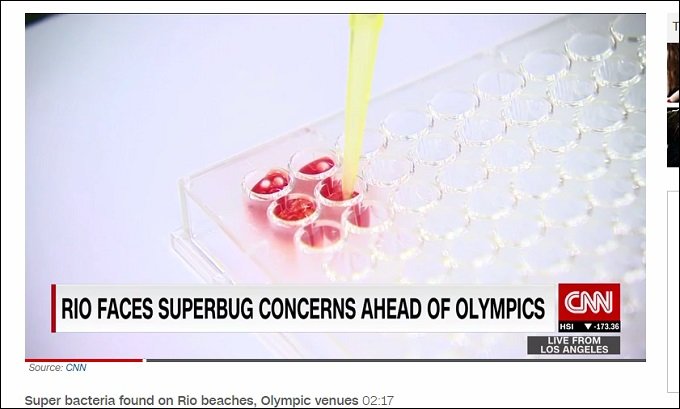 【リオ五輪】会場の海に日々浮かぶ死体がヤバすぎる!致死率50%の「スーパーバクテリア」もの画像4