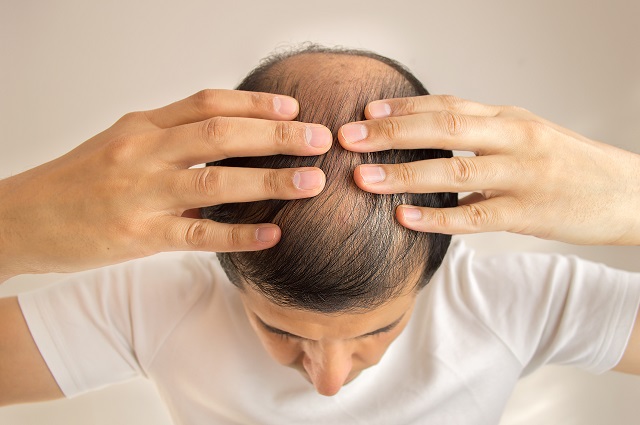髪の毛にも「嗅覚」があることが新判明! アノ匂いを髪に嗅がせてハゲ改善できることも!の画像2