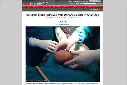 stone.jpg