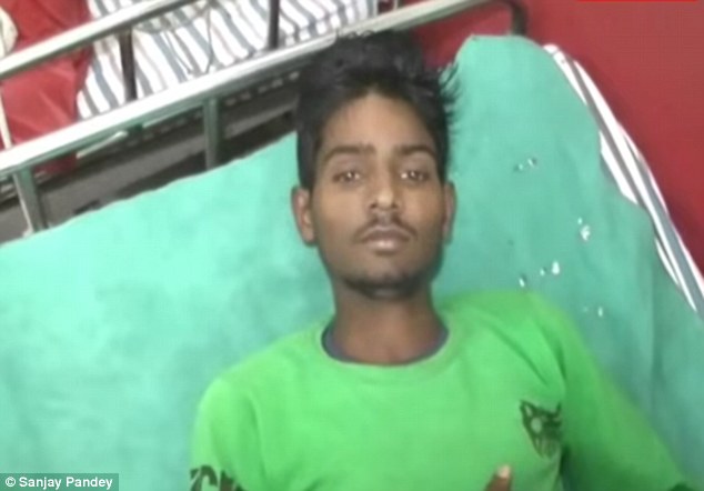 【閲覧注意】男の腹の中から毛むくじゃらの人間が出現=インドの画像1