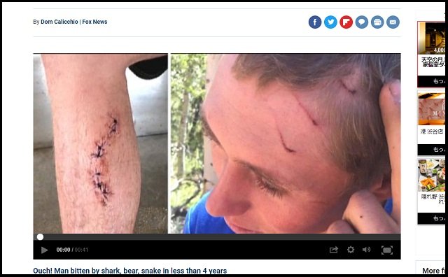 3年間にヘビ・クマ・サメによる連続襲撃を受けた世界一不運な男! 確率89京3千兆分の1!の画像2