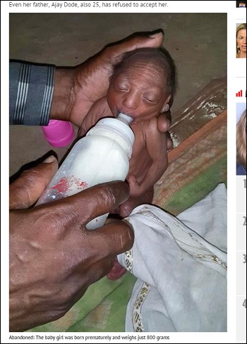 全身シワシワの赤ん坊 育児放棄されヤギのミルクで育てられた2週間 インド