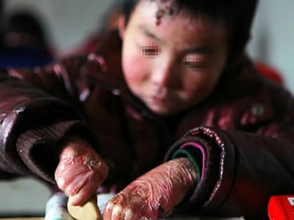 19歳なのに7歳の容姿 究極の童顔少女 苦難続きの人生に光見えた 中国
