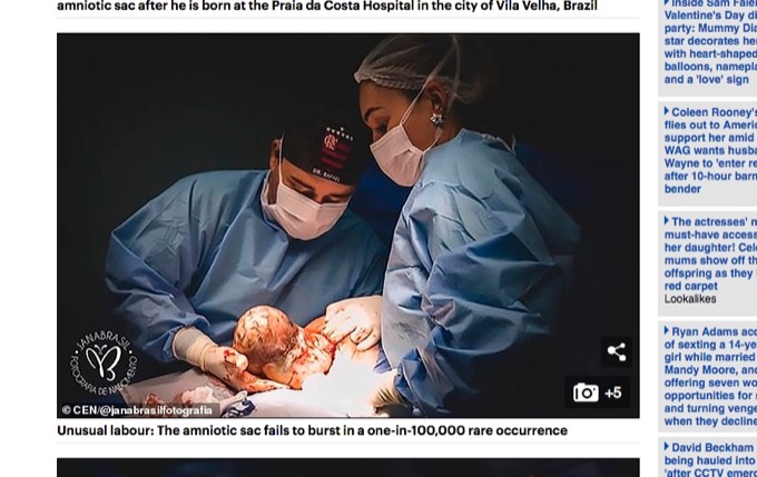 羊膜に包まれて生まれた赤ん坊が神秘的すぎる！ 10万人に1人の奇跡、先天的超能力者の可能性も囁かれる！＝ブラジルの画像3