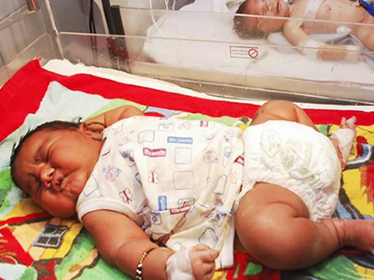 産まれついてのデブ インド最大の赤ちゃん誕生に 角界入り を期待する声