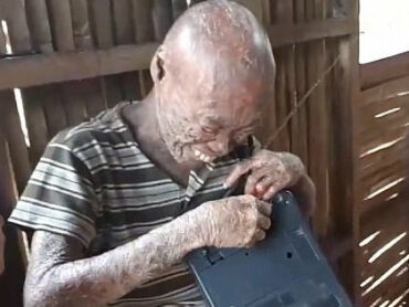 魚鱗癬の検索結果 Tocana