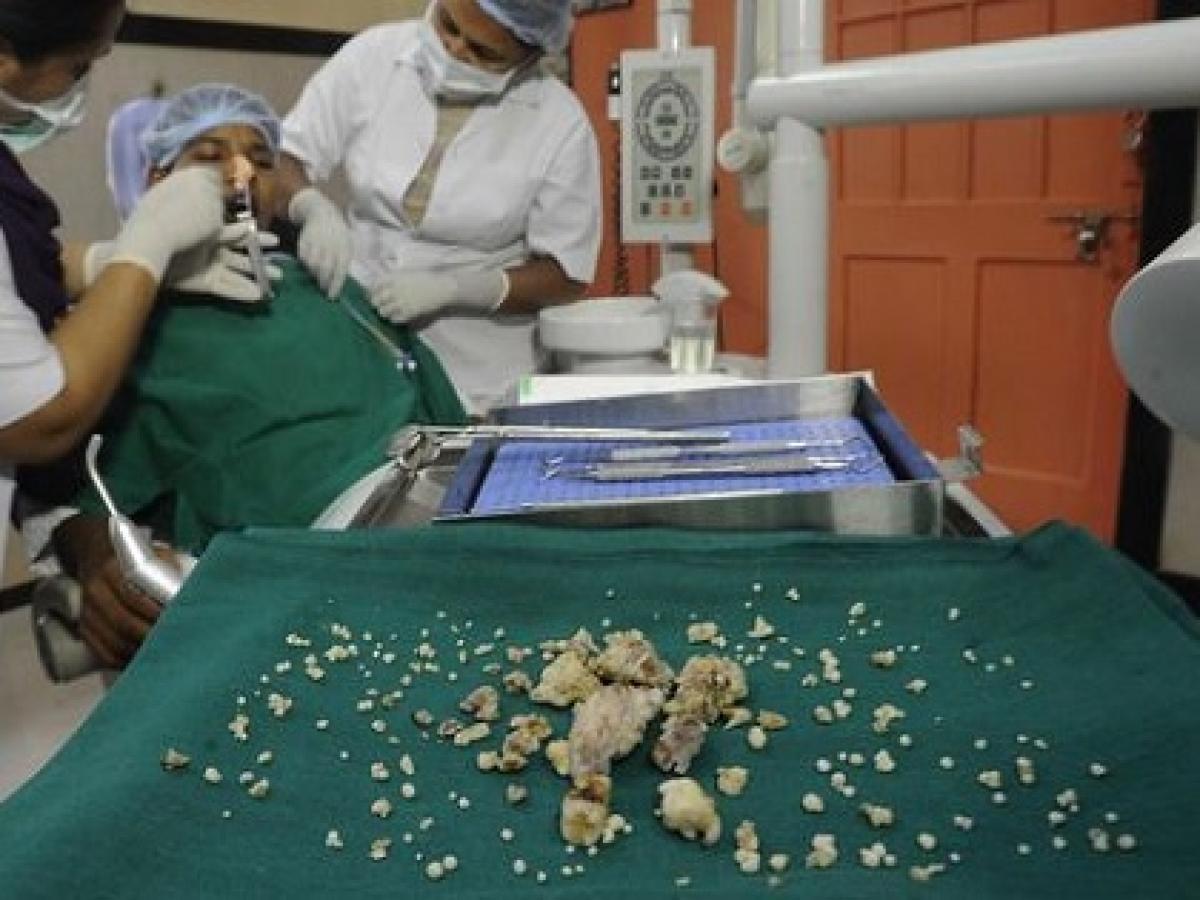 海外の超悲惨なアンビリーバボー歯科治療 インドでは 232本の歯 を摘出 アメリカでは 痛恨の驚愕医療ミス Tocana