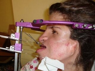 トリーチャー・コリンズ症候群の“顔面崩壊女” ― いじめ・差別を乗り越え56回の手術で回復の兆し、その全記録