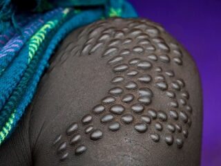 「針とカミソリで肌に模様を刻む」！　アフリカの部族に伝わる風習、スカリフィケーションの実態とは!?