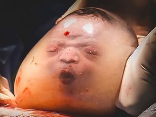 羊膜に包まれて生まれた赤ん坊が神秘的すぎる！ 10万人に1人の奇跡、先天的“超能力者”の可能性も囁かれる！＝ブラジル