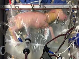 ついに登場した“本物の人工子宮”の映像がヤバすぎる！ 理学博士「ブタや脳死女性の子宮を利用した代理出産も」