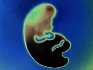 「人間の脳を持った動物」が誕生間近!? 現代のフランケンシュタイン達が挑む“キメラ胚”研究がヤバすぎる