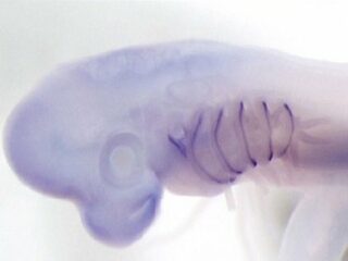 【衝撃】人間の手足は“魚のエラ”から進化した？ 「ソニック・ヘッジホッグ遺伝子」で判明