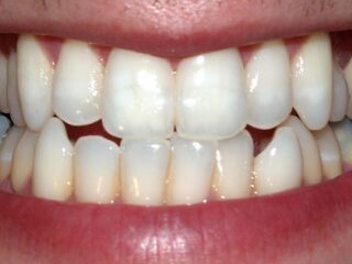 歯の再生が可能になる？　抜けた歯が再び生える最新研究とシクリッドの謎！