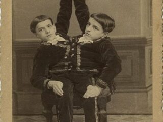 巨人症、アルビノ、結合双生児… 奇形を見世物にした19世紀のフリークショー出演者たち19人大集合！