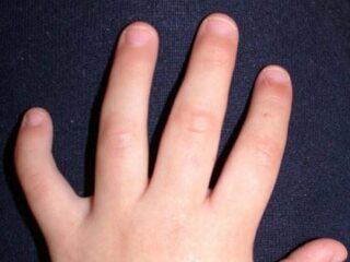 人差し指よりも長い薬指を持つ子どもは自己中で攻撃的!?  モノを独り占めする傾向…実験で判明！