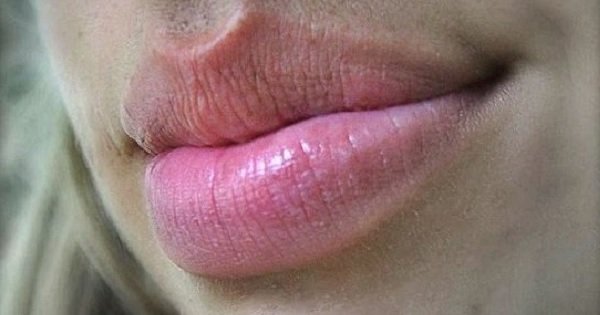 唇の形8パターンでわかる 真の性格診断 がスゴい当たる 整形している人は