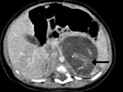 知覚 感情 脳 を共有でも人格は別 美少女結合双生児の不思議な関係