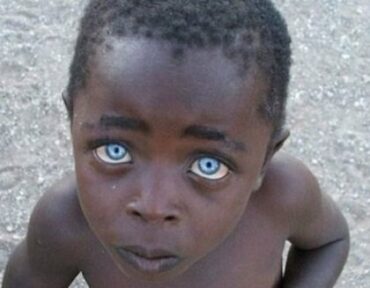 青い ブルグ 目 デン 症候群 ワール “輝く青い目”を持つインドネシア「ブトン族」の人々が神秘的すぎる！ 一度見たら忘れられない「ワールデンブルグ症候群」の真実！