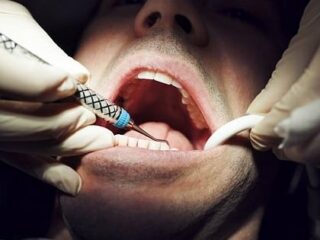 歯医者は患者の不安を「嗅ぎ取って」ミスを犯しやすくなることが判明！ 患者のストレス臭が治療に影響